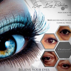 Blepharonat  Eye Bag Reduction